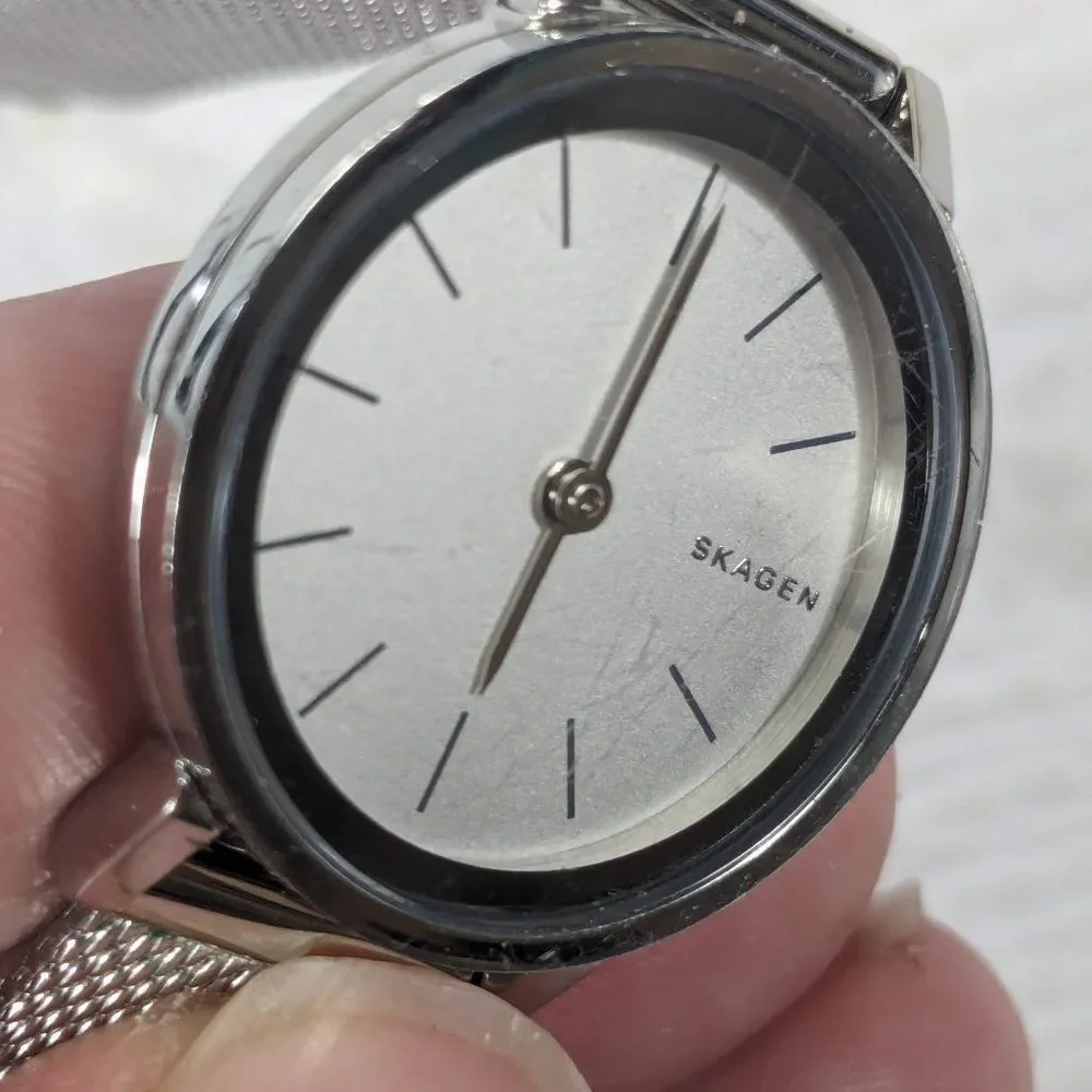 Skagen mesh dress scratches